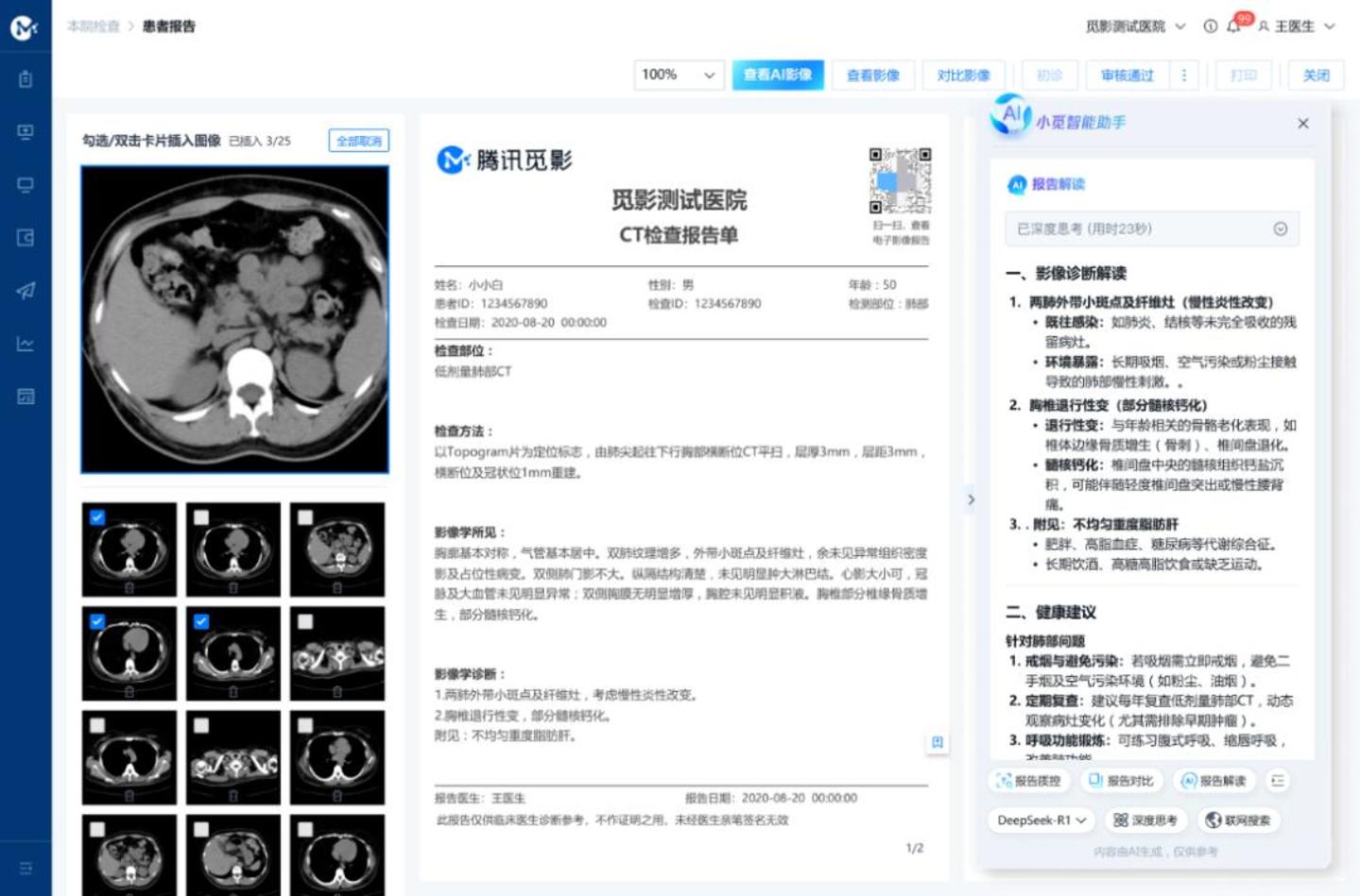 AI扎堆世界杯,技术底牌亮了多少? AI扎堆世界杯,技术底牌亮了多少?