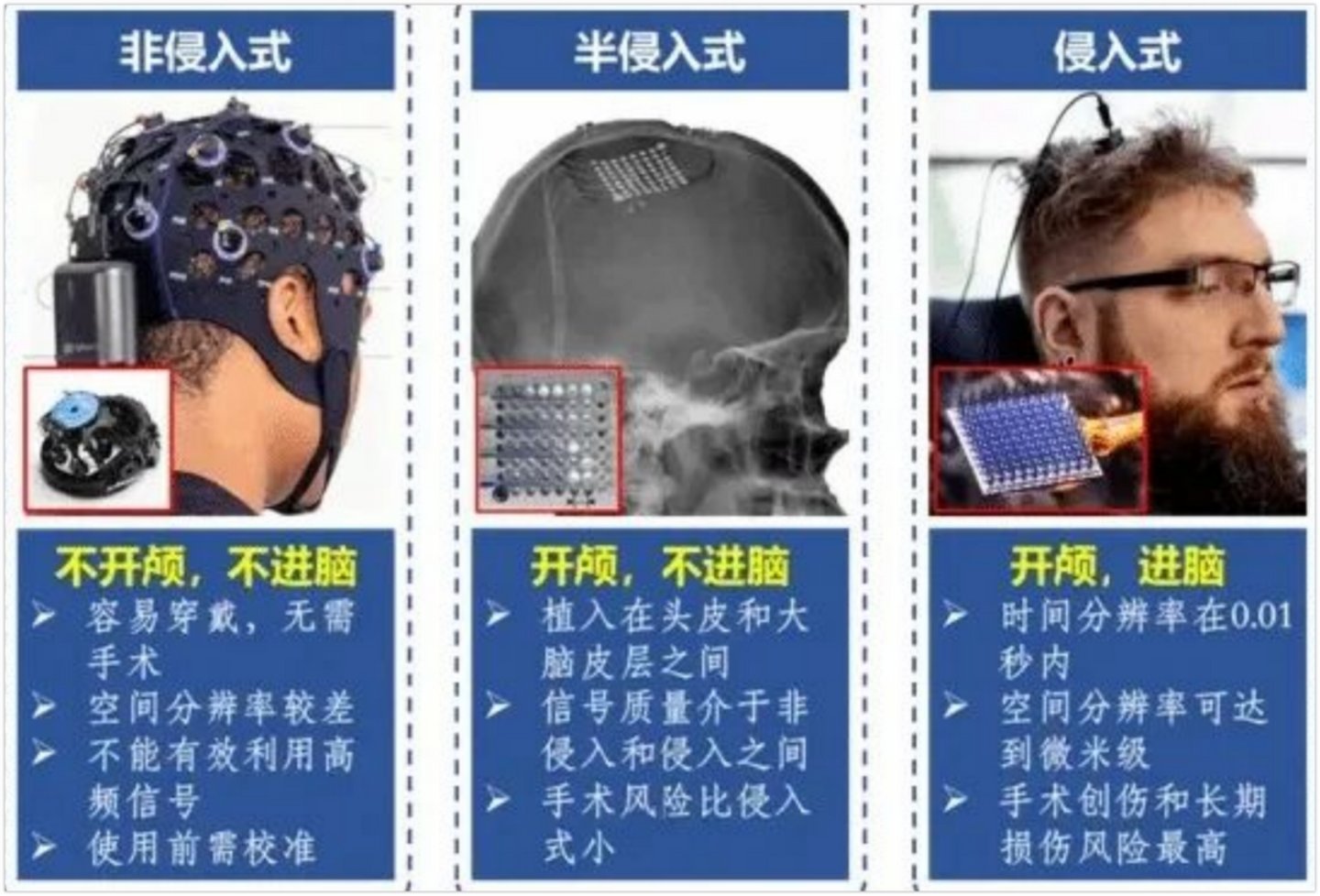 脑机接口，风再起时