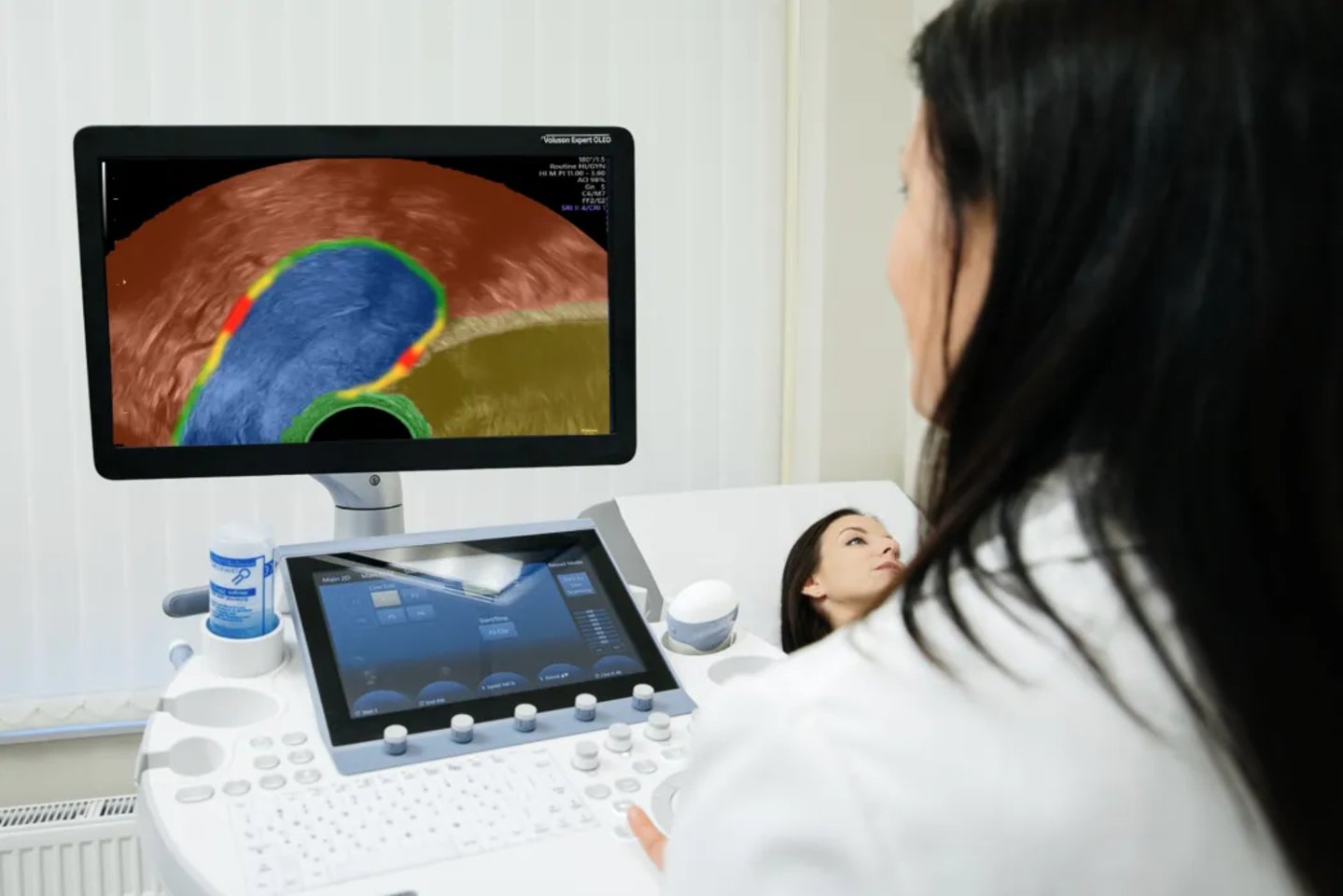  瑞士医疗企业Scanvio Medical研发AI辅助妇科超声诊断软件，提高子宫内膜异位症诊断效率